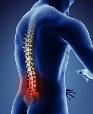 lumbar spondylosis
